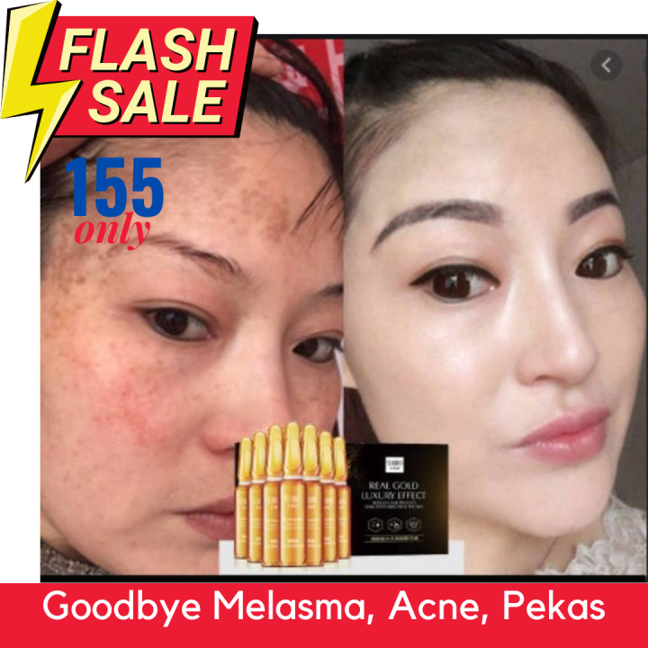 Effective Face Whitening Cream Melasma Remover Serum Anti Aging Cream Wrinkle Remover Anti