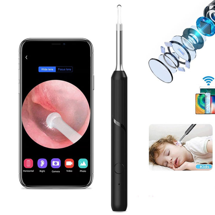 Wireless Smart 3.6mm Earpick With Camera Visual Ear Cleaner Safe Ear Pick  Otoscope NP20 1080P Ear Endoscope Kit LED Flashlight Ear Cleaning Tool with  HD Camera Ear Wax Removal Tool for IOS