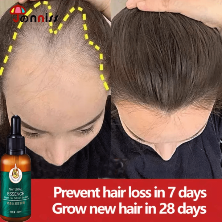 Hair Growth Serum Ginger Hair Treatment Essence Anti Hair Loss Spray Essential Minoxidil Fast 3869