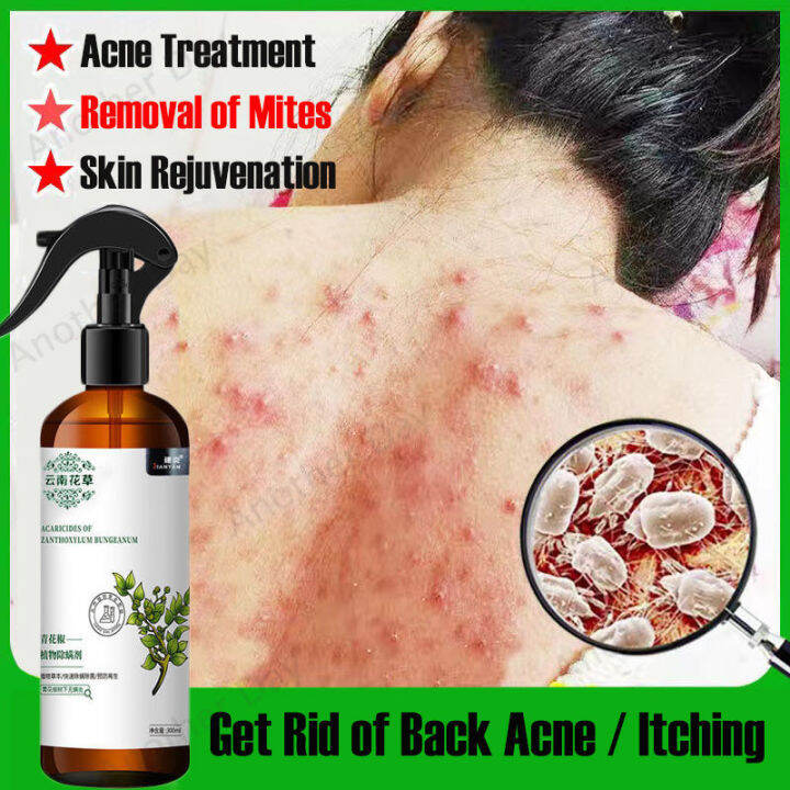 Bug Spray In House While Pregnant at Kristen Parish blog