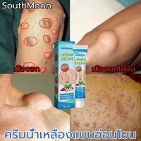 แท้ [South Moon] ออกแบบ36ชนิดของไขมันใต้ผิวหนังกำจัดมวลก้อนไปยังถุงน้ำ Lymph Care Ointment สมุนไพรกำจัด ก้อนเนื้อใต้ผิวหนัง ก้อนซีสต์ ก้อนไขมัน ครีมทาซีส ก้อนไขมัน ครีมระบายน้ำเหลือง ครีมน้ำเหลืองแบบอ่อนโยน ครีมบวมคอ ต่อมน้ำเหลืองบริเวณรักแร้ พร้อมส่งทั่ว