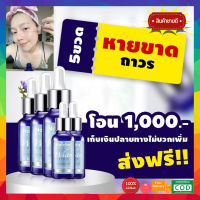 ((5ขวด ของแท้ + ของแถม))  เซรั่มณัชชา serum Natcha White ขนาด 30ml 1 ขวด  5ปีแล้วเซรั่มณัชชา