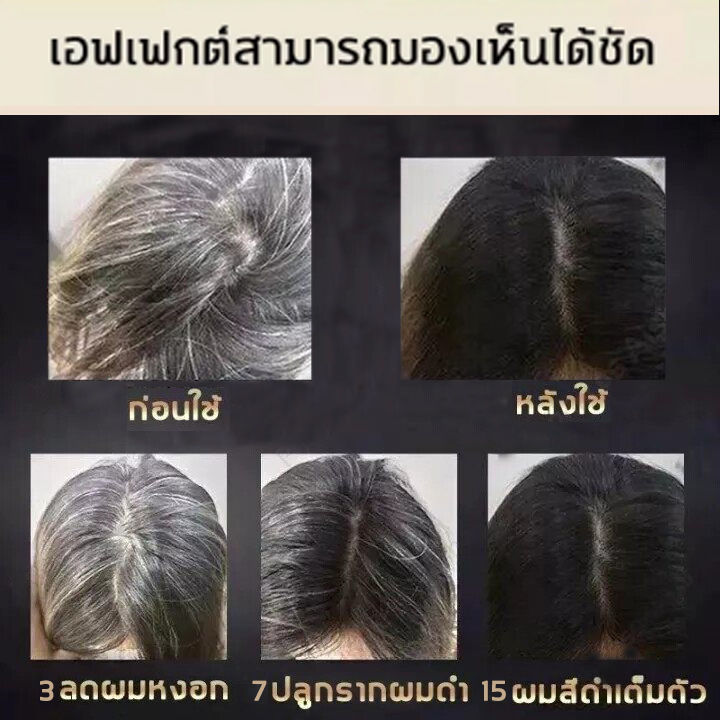 ของแท้-100-eliza-แชมพูปิดผมหงอก-ยาสระผมปิดหงอก-แชมพูแก้ผมหงอก-300ml-แชมภูปิดผมขาว-ล้างออกแล้วดำอย่างธรรมชาติ-แชมพูปิดผมขาว3in1-ยาย้อมผมหงอก-แชมพูปิดผมขาว-ยาย้อมผมแบบสระ-แชมพูสระผมหงอก-แก้ผมหงอก-แชมพูป