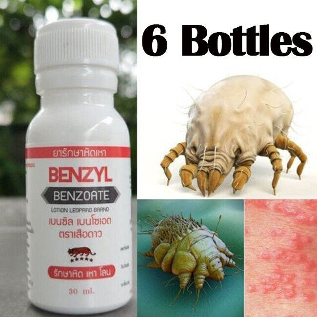 6 Bottles SCABIES TREATMENT LOTION MITE & LICE effective 30ml Lazada