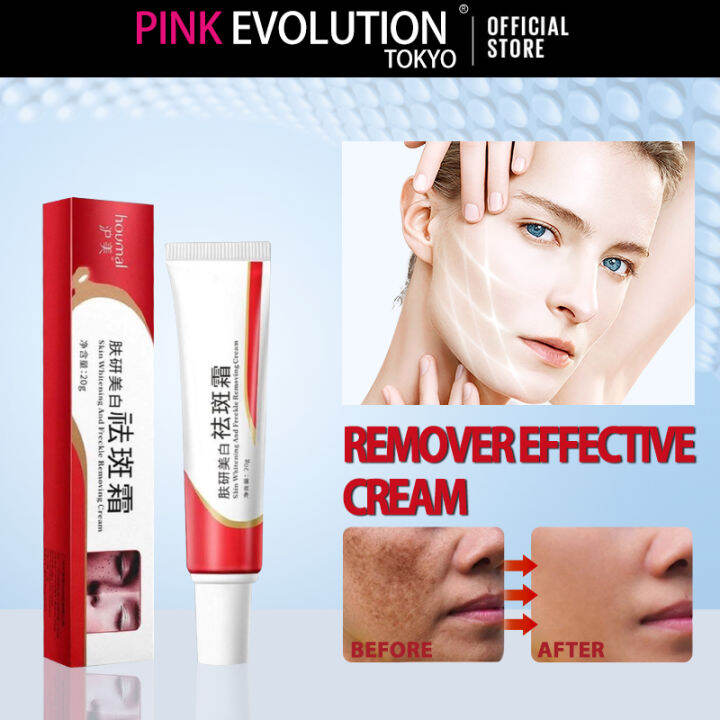 【🇵🇭Ready Stock】Pekas Remover Effective Melasma Cream Anti Freckle ...