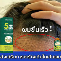 ความจุใหญ่EELHOEเซรั่มปลูกผม30ml ฟื้นฟูผมแห้งเสีย แก้ปัญหาผมร่วง บำรุงรากผม ดูแลผม บำรุงผมแห้ง แตกปลาย ป้องกันผมร่วง( น้ำยาปลูกผม ทรีทเมนต์สำหรับผม ป้องกันหัวล้าน นำ้ยาปลูกหนวด เซรั่มบำรุงผม น้ำปลูกผม ยาปลูกผมของแท้)ทรีนเมนบำรุงผมHair Growth Essential Oil