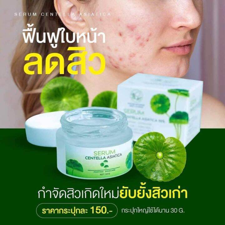 เซรั่มใบบัวบก-ผสมว่านหางจระเข้-ลดสิว-หน้าใส