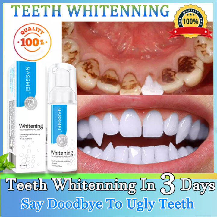 NASSMEI Teeth Whitening Mousse Whitening Toothpaste Teeth Whitening