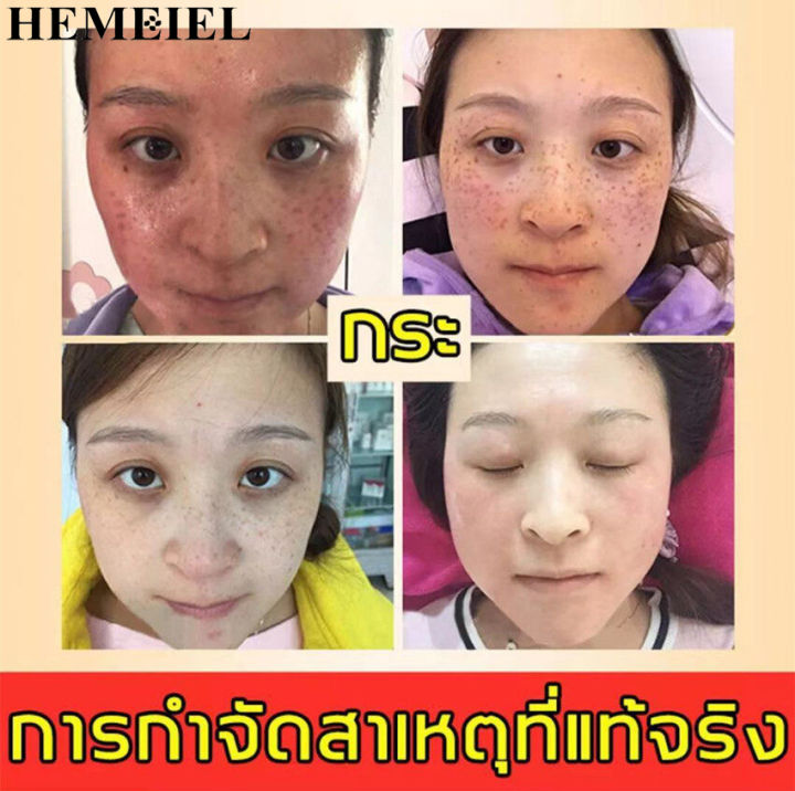 hemeiel-ครีมหน้าสด-ครีมทาฝ้ากระ-วิตซี-vit-c-คนีมหน้าขาวใส-30g