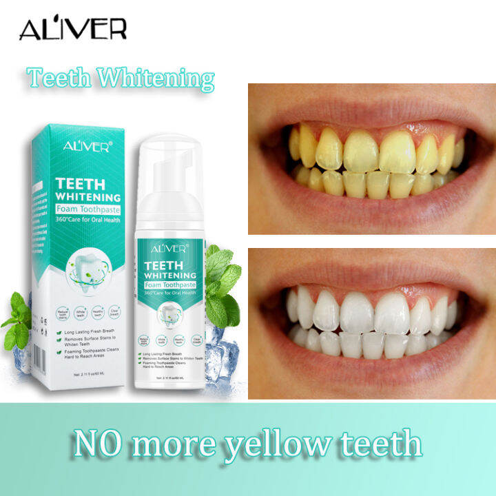 ALIVER Whitening toothpaste to remove stains, mousse, foam teeth
