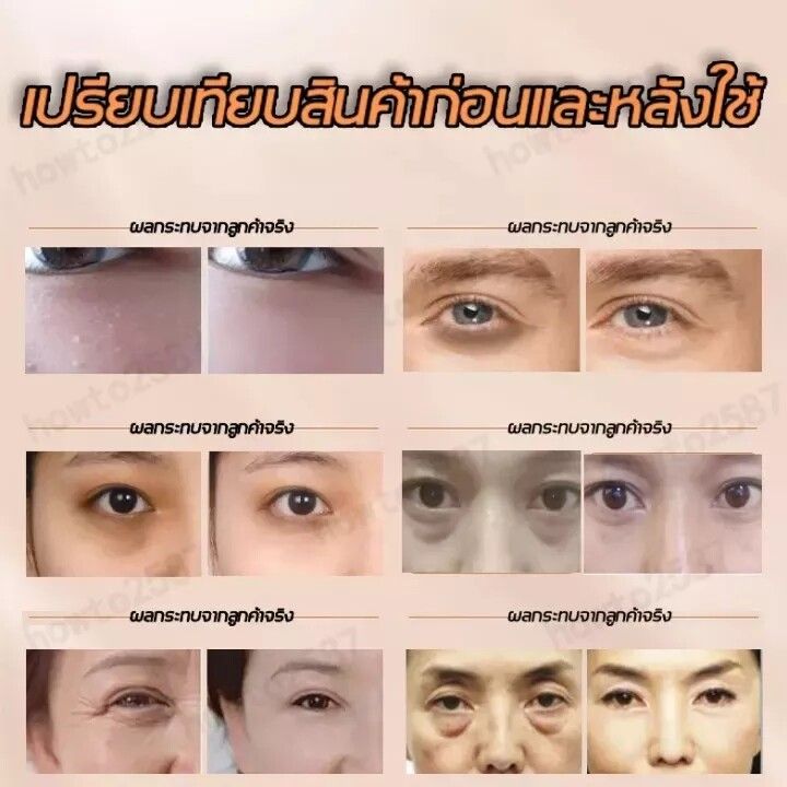 ครีมลดถุงใต้ตา-ครีมทาถุงใต้ตา-ครีมทารอบดวงตา-อายครีมลดใต้ตา-ครีมบำรุงรอบดวงตา-ถุงใต้ตาบวม-กระชับ-ยกกระชับ-eye-bags-remover