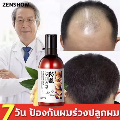 【ของแท้ พร้อมส่ง】รากผมเป็นสีดํา แชมพูปิดผมหงอก แชมพูแก้ผมหงอก แชมพูเหอโส่วอู 250ml my organic แก้ผม หงอก แก้ผมหงอกถาวร แชมพูปิดหงอก ผมหงอกกลับมาดำ แชมพูสมุนไพร น้ำยาแก้ผมหงอก แชมพูผมดกดำ เซรั่มลดผมหงอก แชมพูปิดผมขาว เซรั่มแก้ผมขาว แชมพูสระผม