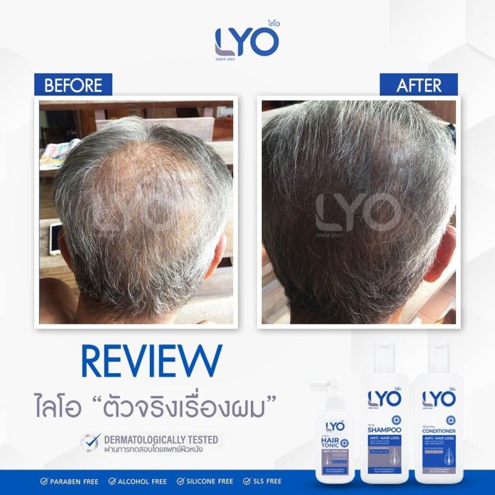 แพ็คคู่-ราคาพิเศษ-lyo-hair-tonic-ไลโอ-แฮร์โทนิค-30-ml-เซรั่มบำรุงผม-ลดผมร่วง-เพิ่มผมหนา-ผมดกดำ