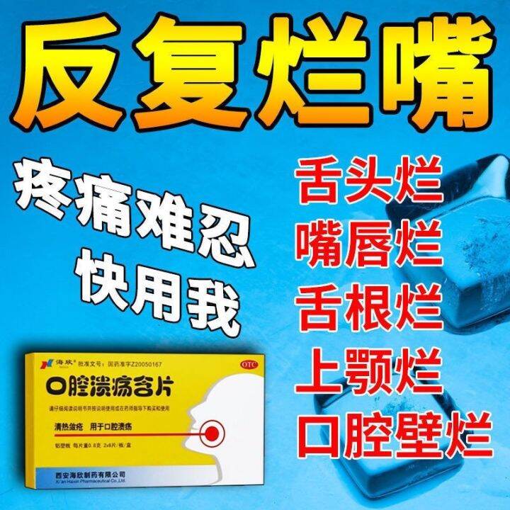 Treatment Of Recurrent Oral Ulcers Ulceration Blistering Tongue Sores