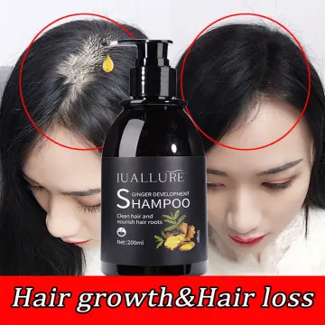 Shop Herbal Hair Growth Anti Hair Loss online - Aug 2022 