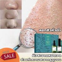 AOPY สูตรอ่อนโยน กำจัดสิวหัวดำ 3 in 1 Set ลบสิวหัวดำและสิว บำรุงกระชับรูขุมขน ขจัดผิวที่ตายแล้ว ผิวกระจ่างใส ครีมลอกสิวเสี้ยน ลอกสิวหัวดำ สิวอุดตัน ลอกได้ทั้งหน้า สูตรใหม่ สำหรับคนเป็นสิว และผิวแพ้ง่าย ( ที่ลอกสิวเสี้ยน ลอกสิวเสี้ยน มาร์คหน้าสิวเสี้ยน)