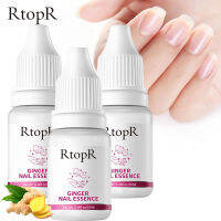 RtopR 3 ชิ้น FDA  ยาทาเล็บ ขิง เซรั่มรักษาเล็บ เซรั่มซ่อมเซมเล็บ GINGER NAIL ESSENCE