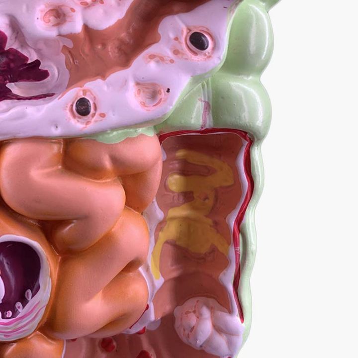 human-digestive-system-model-stomach-anatomy-large-intestine-cecum-rectum-duodenum-human-internal-organs-structure-model