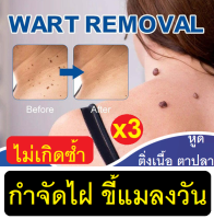 (3 หลอด) กำจัดไฝ ขี้แมลงวัน กำจัดถึงราก ไม่เกิดซ้ำ ขนาด 20g.