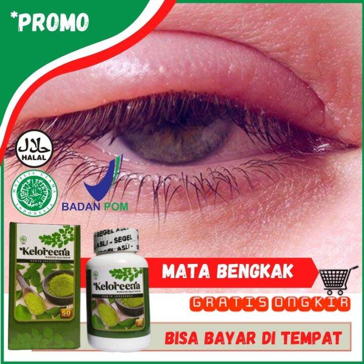 Obat Herbal Untuk Mengatasi Glaukoma, Kerusakan Saraf Mata, Jamu Buat ...