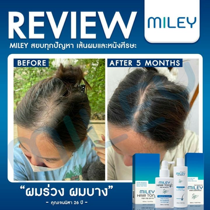 โปร-2แถม2-แชมพูลดผมร่วง-มิลเล่-แฮร์-แชมพู-miley-hair-tonic-miley-hair-shampoo-ผลิตภัณฑ์ดูแลเส้นผม-จากเกาหลี