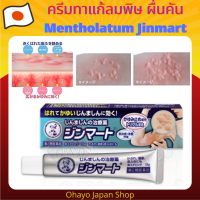 ครีมทาผื่นคัน ลมพิษ ผื่นแพ้ต่างๆ Rohto Mentholatum Jinmart ขนาด 15 กรัม