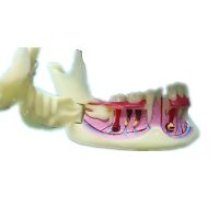 Dental Mandible Model Endodontic Treatment Model Anatomy Of Gums Dental Study Teach Teeth Model