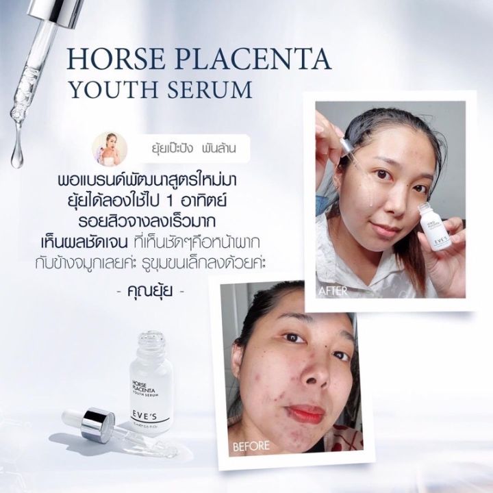 เซรั่มรกม้า-เซรั่มหน้าเด็ก-horse-placenta-eves-อีฟส์แท้100