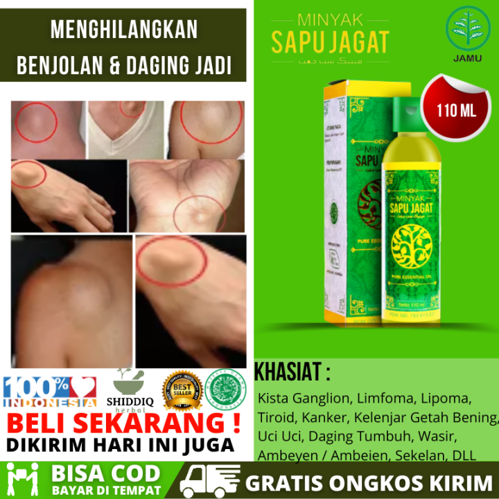 Minyak Untuk Gatal Eksim Obat Oles Gatal Gatal Jamur Kulit Hapur