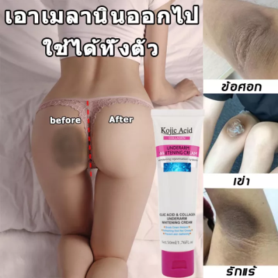 Kojic Acid ครีมบำรุงรักแร้ ศอกดำ ครีมทา ครีมทาขาหนีบดำ ครีมทารักแร้ดำ ครีมเข่าขาว ครีมทารักแร้ดำ ครีมทารักแร้ขาว ครีมทาคอดำ ครีมบำรุงรักแร้ หัวเข่าดำ ครีมบำรุงคอ ครีมทารักแร้ดำ ครีมเข่าขาว ครีมทาขาหนีบดำ รีมบำรุงรักแร้ ครีมขาขาว ครีมทาผิว