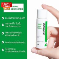 Oxe cure facial acne lotion 10 ml.