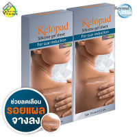 Kelopad Silicone Gel Sheet คีโลแพด ซิลิโคนเจล ชีท [2 แผ่น] แผ่นซิลิโคนเจล ลดเลือน รอยแผลเป็น