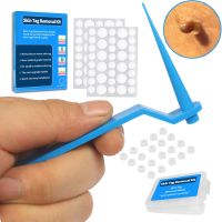 Skin Tag Remover Kit Skin Mole Wart Remover 2 4mm 4 8mm 2 In 1 Auto Painless Moles Warts Removal Beauty Tools