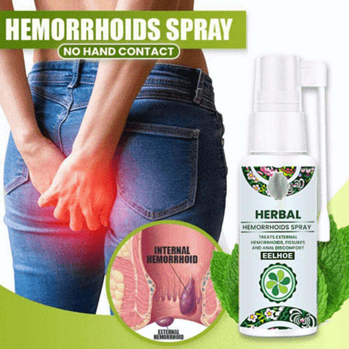 30ml HERBAL hemmoriod spray ointment hemorrhoids miracle ointment
