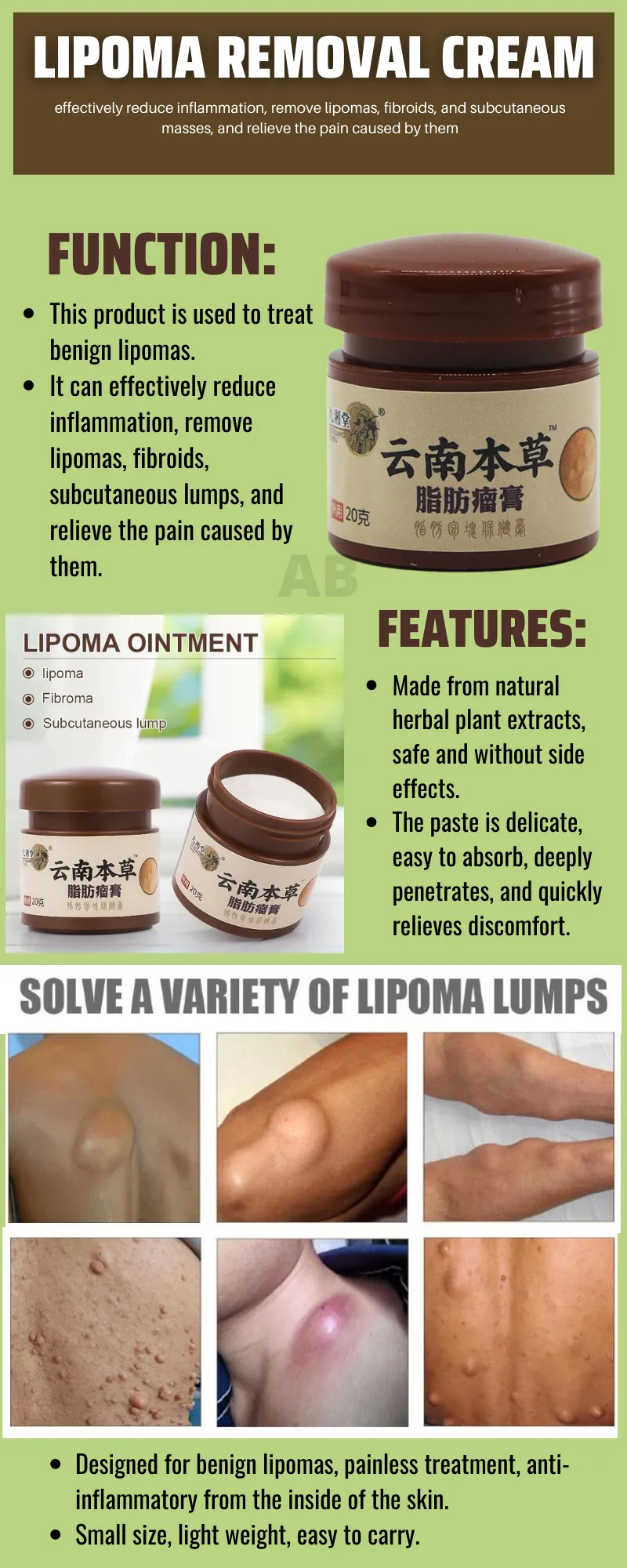 SUPER SALE!!20g Lipoma Removal Cream natural herbal plant extracts, it is  safe and has no side effects Fast Effect | Lazada PH