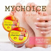 Mychoice Foot cream 60g ครีมทาส้นแตก ผลิตภัณฑ์ดูแลเท้า เท้าแตก น้ำมันม้า ครีมบำรุงเท้า ครีมทาเท้า ครีมทาส้นเ ดูแลเท้า