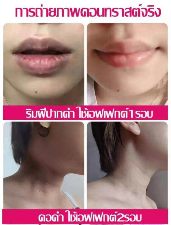 peimeiครีมหัวนมชมพู-ครีมทาน้องสาว-ครีมทาหัวนมชมพู-ที่ทาหัวนมชมพ-ลดอายุน้องสาว-ตกตะกอนรักษาเม็ดสีเมลานิน-ครีมรักแร้ขาว-รักแร้-หัวนม-ข้อต่อกระดูกที่ลับ-ครีมทาผิวขาว-ครีมทาขาหนีบดำ-ครีมทาก้นดำลาย-ครีมทาแ