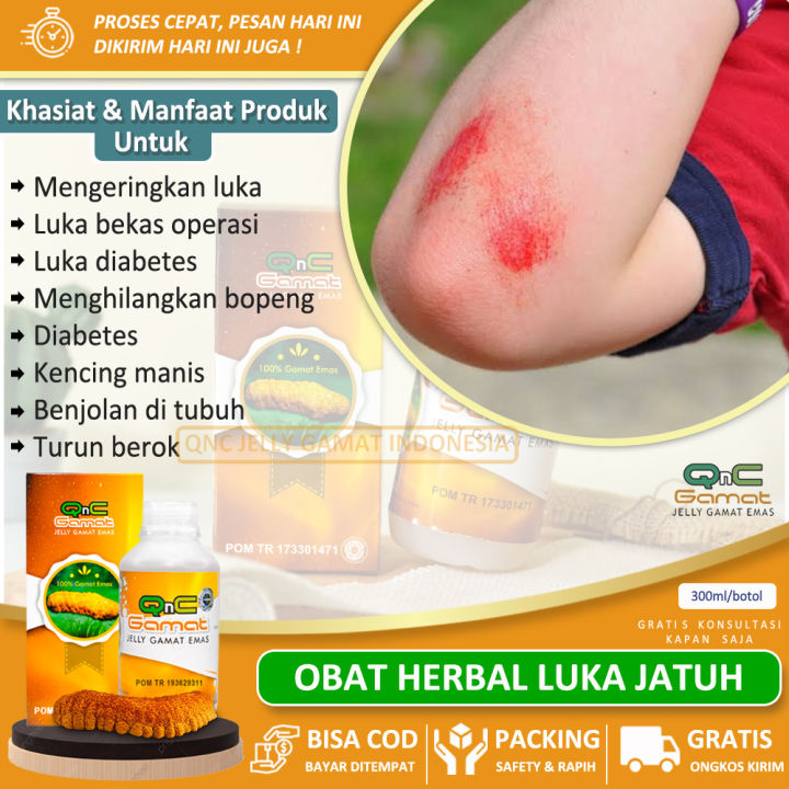 Solusi Obat Luka Jatuh Dari Motor Mengeringkan Bekas Luka Jatuh Bakar