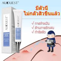 AuQuest ครีมลดสิว กำจัดสีว สิวอุดตัน สิวผด ไม่มีหัว หลุมสิว ซ่อมแซมรอยสิว ลอกสิวเสี้ยน กำจัดสิว ทำความสะอาดองล้ำลึก-1519