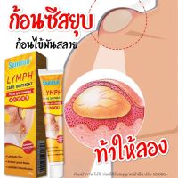 ครีมทา ก้อนไขมันซีส  1 ชิ้น 89 บาท ขนาด 20 กรัม พร้อมส่ง