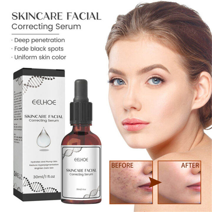 Retinol Dark Spot Remover Face Serum Whitening Skin Care Freckle ...