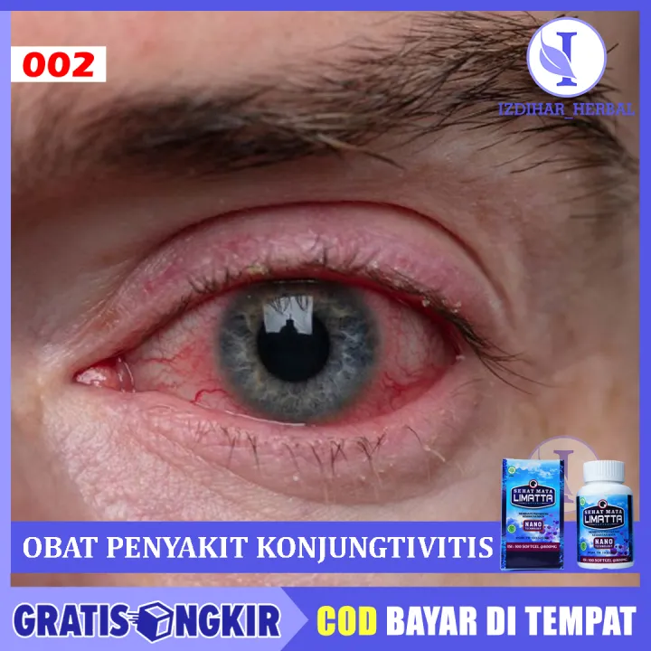 Obat Infeksi Mata Penyakit Konjungtivitis Gatal Berair Radang Mata Merah Dan Belekan Dengan 1175