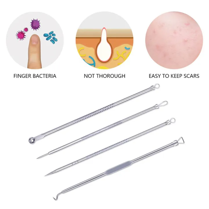 เซ็ตชุดกดสิว-4-ชิ้น-8-หัว-ที่กดสิว-ชุดกดสิว-อุปกรณ์กดสิวพร้อมกล่อง-ที่กดสิวอุดตัน-สิวและจุดด่างดำ-acne-tool
