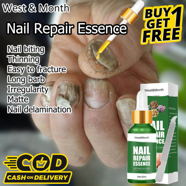 【BUY 1 TAKE 1】WEST&MONTH Nail repair essence Nail repair essence serum