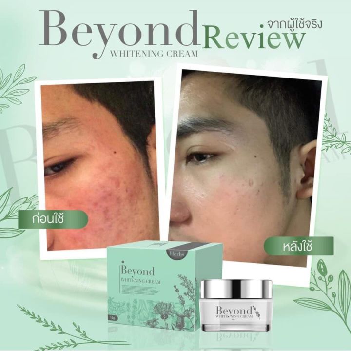 beyond-whitening-cream-10-g-08349-บียอน-ไวท์เทนนิ่ง-ครีม-บำรุงผิวหน้า-ช่วยให้ผิวหน้าขาว-กระจ่างใส