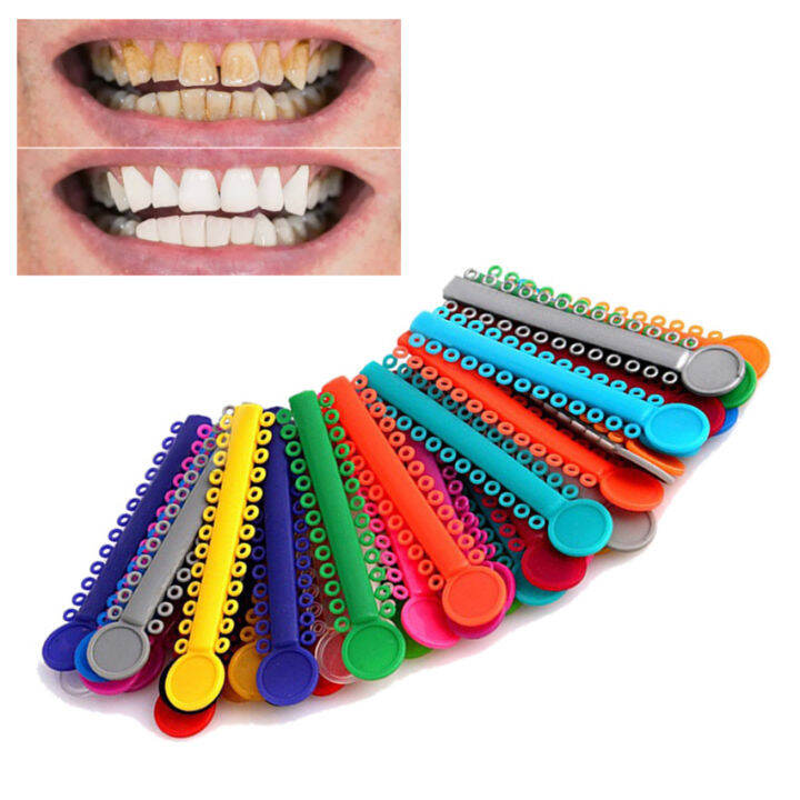 40pcs Rubber Brace Elastic Rubber Bands Assorted Color Lazada PH