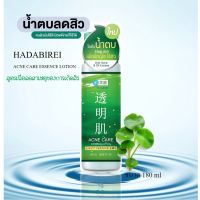 [มาใหม่]น้ำตบ HADABIREI ACNE CARE ESSENCE LOTION ขนาด 180 ml สูตรเพื่อลดสาเหตุของการเกิดสิว