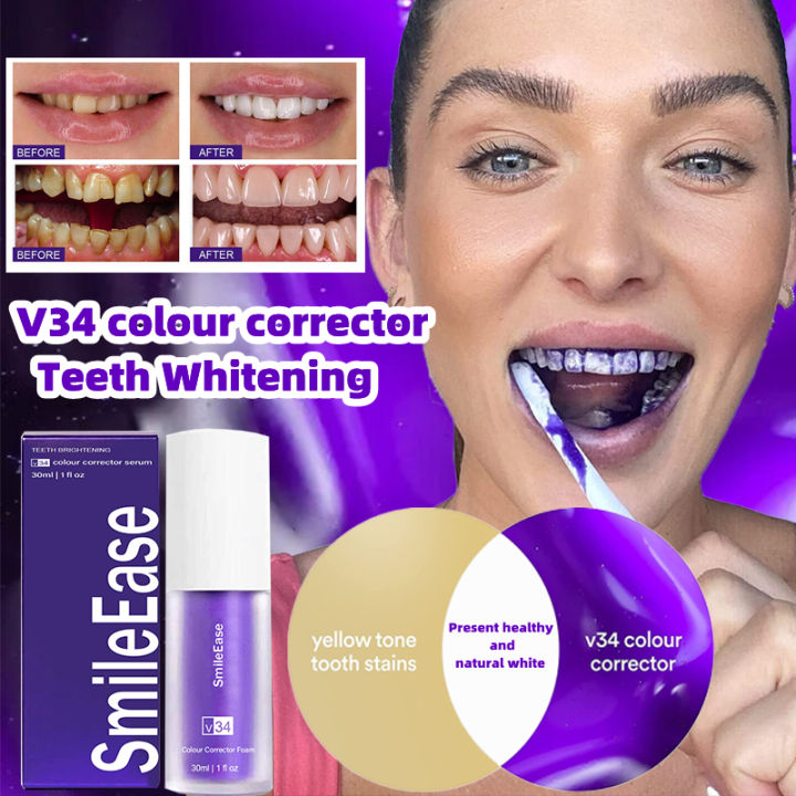 hismile v34 toothpaste colour corrector my smile ubat gigi teeth whitening Purple Tooth Stain