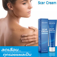 EELHOE ครีมลดรอยแผลเป็น scar crea เจลดูแลรอยแผลเป็น m30g เจลลดรอยแผลเป็นจากสมุนไพรจากธรรมชาติ ทำให้มีสรรพคุณช่วยลดรอยแผลเป็นนูนแดง ป้องกันหลุมสิวและช่วยในการสมานแผลได้เป็นอย่างดี ทั้งยังช่วยบำรุงผิวที่มีปัญหาแผลเป็นให้นุ่มขึ้น