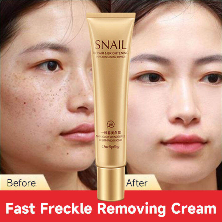 100 Original Whitening Freckle Cream Melanin Moisturizing Hydrating Skin Care Freckle Cream 9605